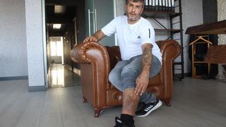 Ameliyatta bacağında bez parçası unutuldu: 16 senedir bir kumaş parçasıyla yaşamışım