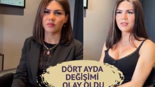 Cinsiyet değiştirme ameliyatından sonra ses estetiği yaptırdı! 4 ay sonraki değişimi sosyal medyada viral oldu