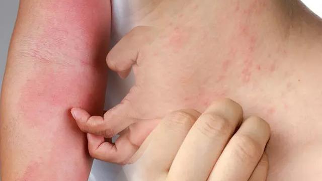 Vakalar her geçen gün katlanarak artıyor! Uzmanlar uyardı, 15 dakika bile yeterli: Bu belirtiler varsa...