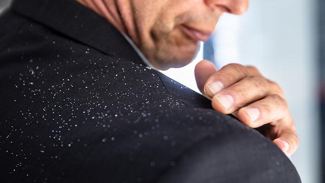 Saç kepeği diyerek görmezden gelmeyin! Kafa derisinde görülen bu durum o hastalığın habercisi olabilir