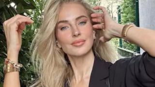 Burcu Esmersoy genç kızları estetik konusunda uyardı! Eski hali gündem oldu