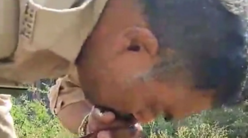 Zehirlenerek hayatını kaybeden yılanı ilk yardım yaparak kurtardı! Zehri emerek çıkarttı... Dakikalarca uğraştı