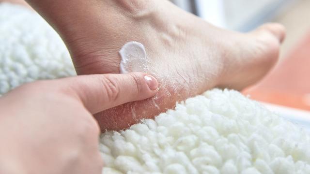 Topuk çatlağı neden olur, nasıl geçer? Topuk çatlakları nasıl giderilir?