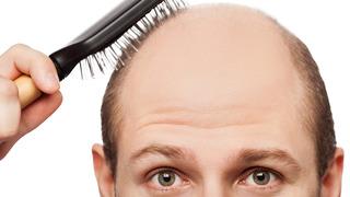 Saç dökülmesi sorunu olanlar dikkat! 1 damlası bile etki gösteriyor, mucizeye tanık olun