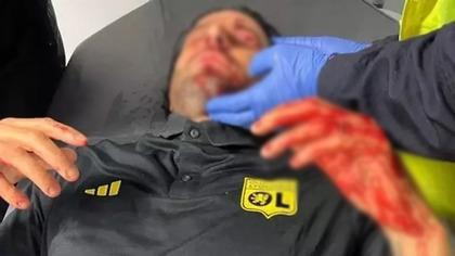 Fransız derbisi öncesi skandal! Marsilyalı taraftarlar Lyon otobüsüne taşlarla saldırdı, teknik direktörü Fabio Grosso kanlar içinde kaldı... Maç ertelendi!