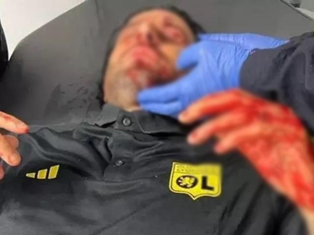 Derbi öncesi skandal! Teknik direktör kanlar içinde kaldı