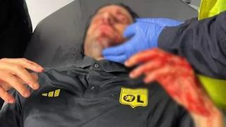 Fransız derbisi öncesi skandal! Marsilyalı taraftarlar Lyon otobüsüne taşlarla saldırdı, teknik direktörü Fabio Grosso kanlar içinde kaldı... Maç ertelendi!