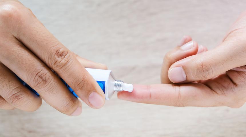 Fito krem nedir, ne i&ccedil;in kullanılır? Fito krem nasıl kullanılır?