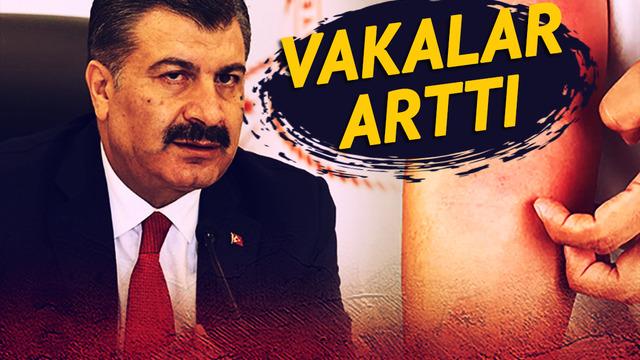 Son dakika | Uyuz vakalarındaki artış sonrası Bakan Koca açıkladı: 'Çok yakın takip ediyoruz!' Deprem bölgesini işaret etti