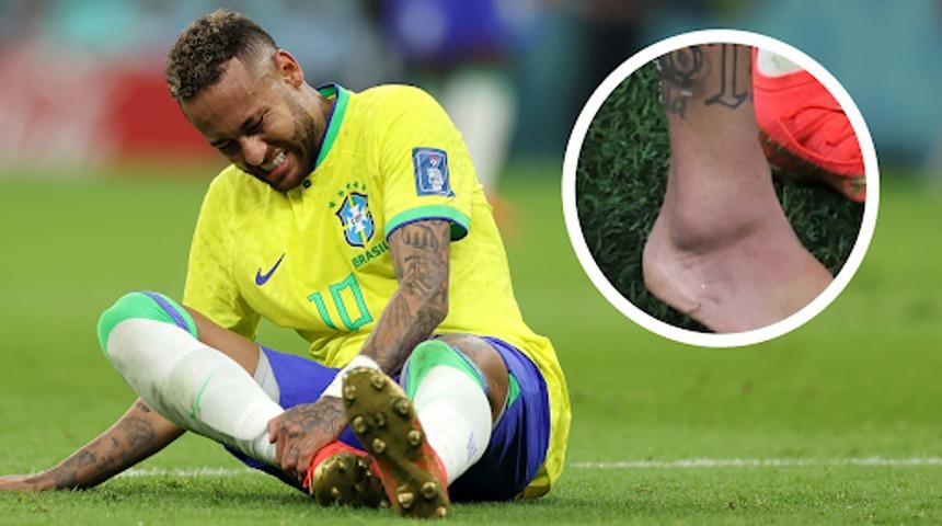 Uruguay-Brezilya maçında sakatlanan dünyaca ünlü yıldız Neymar sahalardan 1 yıl uzak kalabilir