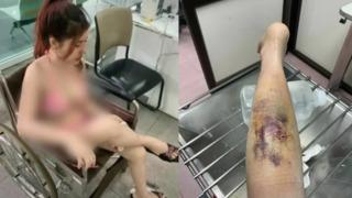 Hayvanat bahçesini ziyaret eden kadına maymun saldırdı! Bacağının arkasına yapışıp dişlerini geçirdi... Sosyal medyadan paylaşınca olay oldu