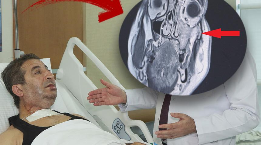 Diş ağrısı nedeniyle hastaneye gitti, gerçeği öğrenince şoke oldu: 'Çok sinsi ilerliyor, 1 ay daha geç kalsaydı...'