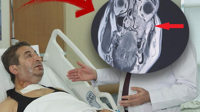 Diş ağrısı nedeniyle hastaneye gitti, gerçeği öğrenince şoke oldu: 'Çok sinsi ilerliyor, 1 ay daha geç kalsaydı...'