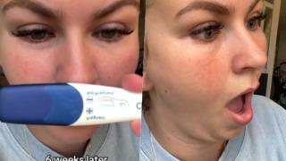 İlk bebeğini doğurduktan 6 hafta sonra yeniden hamile kaldı! İrlandalı ikizler itirafı tepkilerin odağına yerleşti 