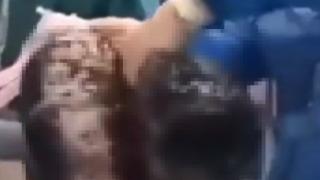 Otuz yıldır her gün sigara içen adamın akciğerlerinin görüntüsü çok konuşuldu! Organlarını bağışlamak istemişti ama...