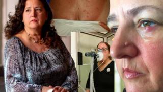 Üniformalarının kendilerini hasta ettiğini söylediler! Uçuş görevlilerine 1 milyon dolar tazminat ödendi