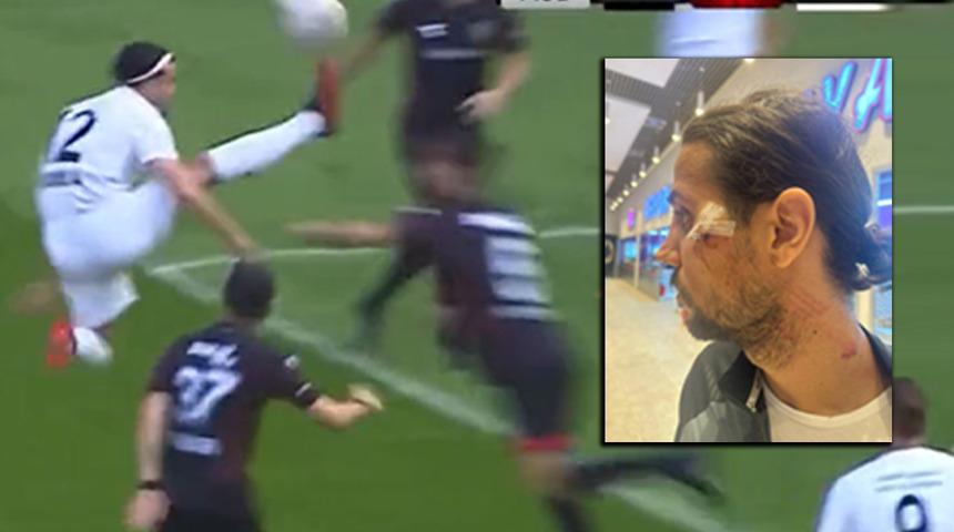 T&uuml;rkiye'de hakem tartışmalarına bir yenisi daha eklendi! 2.Lig Beyaz Grup'ta oynanan m&uuml;cadelede sarı kartın &ccedil;ıkması tepkilere yol a&ccedil;tı