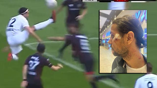 Türkiye'de hakem tartışmalarına bir yenisi daha eklendi! 2.Lig Beyaz Grup'ta oynanan mücadelede sarı kartın çıkması tepkilere yol açtı