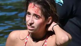 3 metrelik timsah saldırısından mucizevi şekilde kurtuldu! Kadını başından ısırdı... Kafasını ağzının içinde gördüm