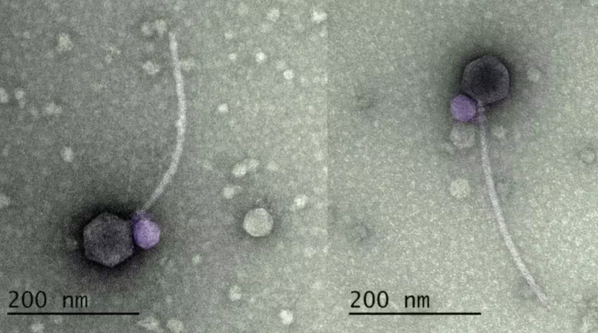 Vampir virüs kabusu! Bilim insanları şokta! İlk tepkisi 'buna inanmıyorum' oldu