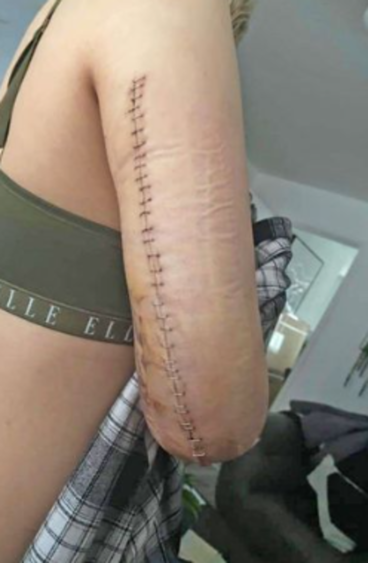 Tacizci erkek arkadaşı önce darp edip kolunu kırdı! Sonrasında gizlice kaydedilen cinsel ilişki görüntülerini ailesine gönderdi G3