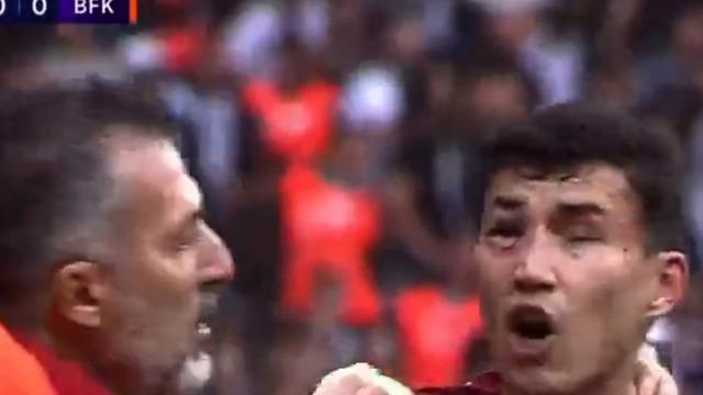 Bahtiyar Zaynutdinov'un gözü morardı, kaşı açıldı! Hastanede tetkikleri yapıldı, burnu ve göz çukuru kırıldı