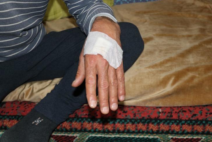 Koyun otlatırken başına geldi! Vücuduna yaklaşık 30 dikiş atıldı: “Köpekler olmasaydı öteki dünyaya gitmiştik” G5