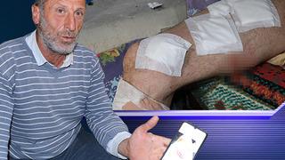 Koyun otlatırken başına geldi! Vücuduna yaklaşık 30 dikiş atıldı: “Köpekler olmasaydı öteki dünyaya gitmiştik”