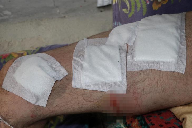 Koyun otlatırken başına geldi! Vücuduna yaklaşık 30 dikiş atıldı: “Köpekler olmasaydı öteki dünyaya gitmiştik” G2