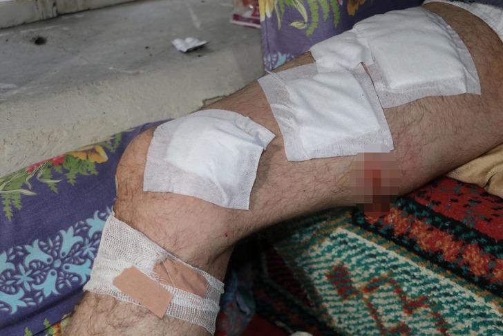 Koyun otlatırken başına geldi! Vücuduna yaklaşık 30 dikiş atıldı: “Köpekler olmasaydı öteki dünyaya gitmiştik” G4