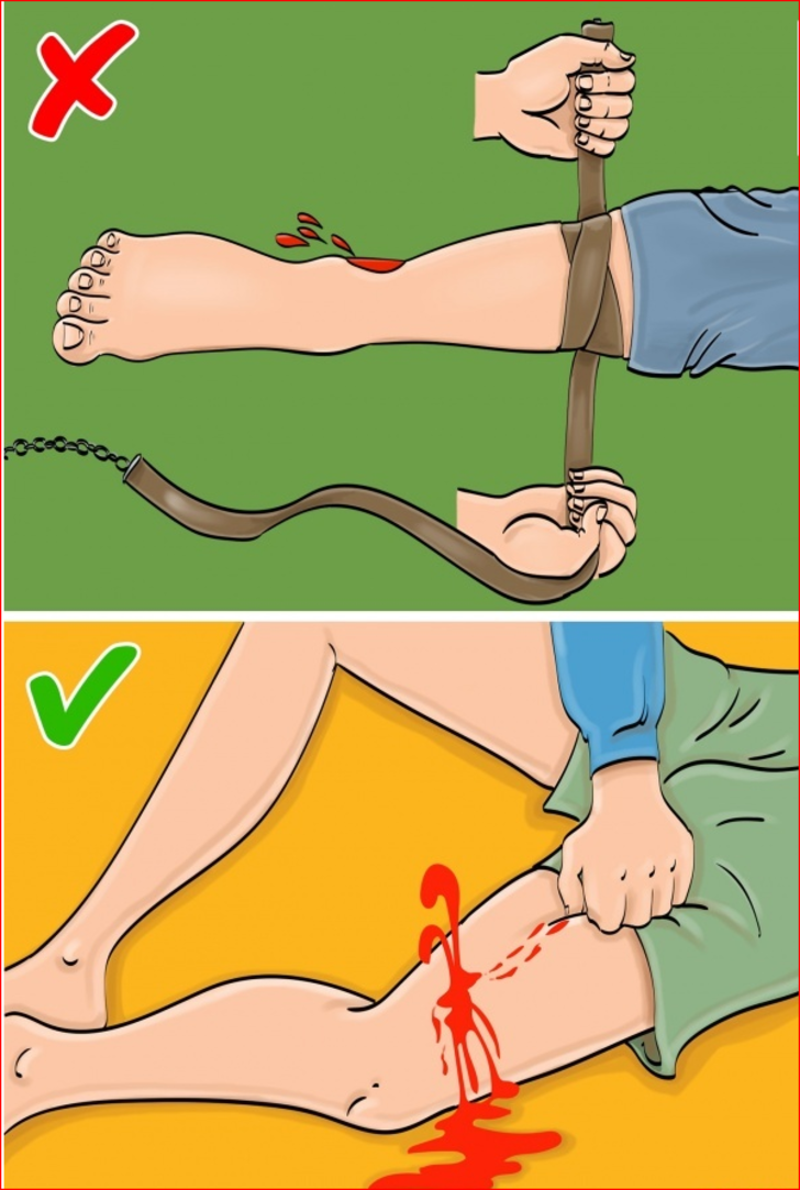  Şiddetli kanama olması durumunda