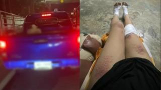 Taylandlı kadın kocasını ve sevgilisini durdurmak için motosikletle arabanın önünü kesti! Yetmedi aracın üzerine tırmandı... Her yeri yaralandı