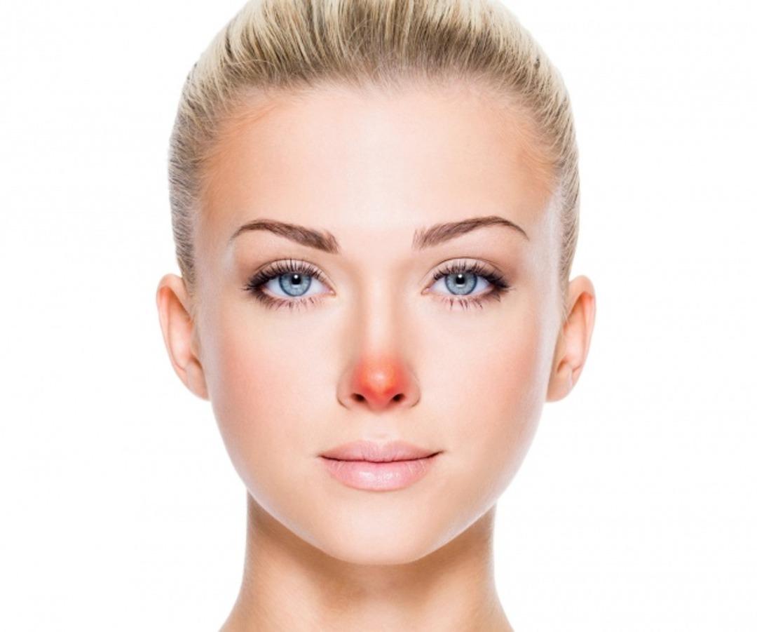 Y&uuml;z&uuml;n&uuml;zdeki problemler i&ccedil; sağlığınızı ele veriyor