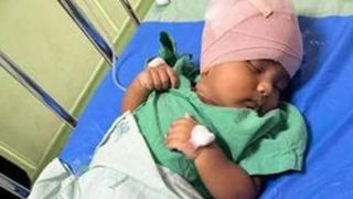 Korkunç olay! Elindeki sütü almak  isteyen maymun saldırdı... Yatağa tırmanarak bebeğin kafasını ısırdı