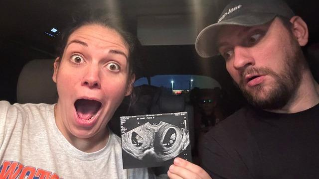 Milyonda bir ihtimal gerçek oldu! Çift rahimli kadın, iki rahminde ayrı bebeklere aynı anda hamile kaldı