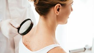 Cilt (Deri) kanseri nedir? Cilt kanseri olduğumu nasıl anlarım?