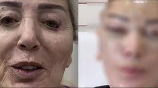 Seda Sayan ablası Nursel Sayan'a estetik yaptırdı! Son halini gören şoke oldu