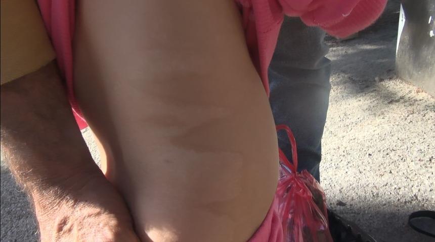 Özel hastanede skandal! Bebeğin vücudunda yanık izleri oluştu, mahkemenin kararı şaşkına çevirdi