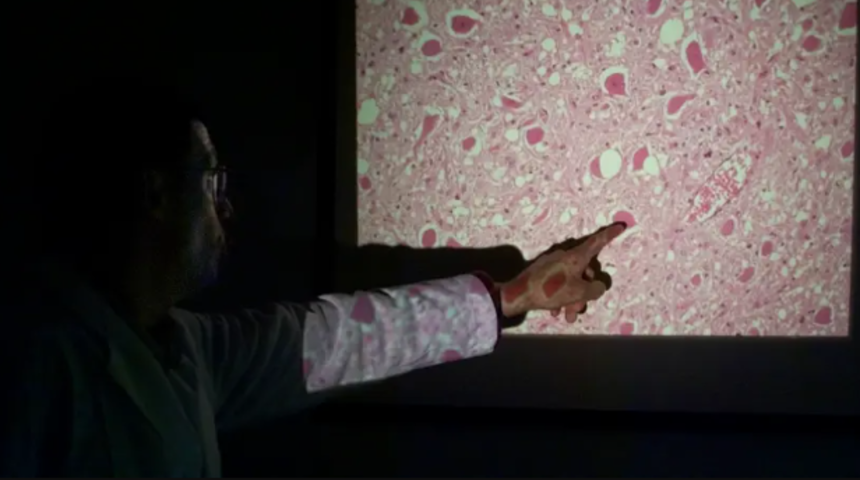 "Deli dana" hastalığı ile aynı aileden! Zombi geyik hastalığı yayılıyor... "İnsanlar için de risk olabilir"