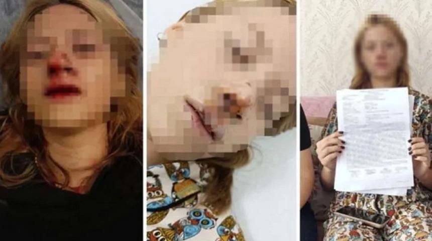 İstanbul'da liseli genç kızın suratına taş atıp dişlerini kırmıştı! Yeni gelişme: Tahliye edildi