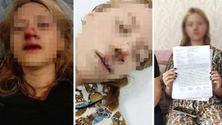 İstanbul'da liseli genç kızın suratına taş atıp dişlerini kırmıştı! Yeni gelişme: Tahliye edildi