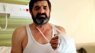 Çatı onarırken eli koptu, 4 saatlik müdahaleyle yerine dikildi! Yaşadıklarını böyle anlattı: Baktım elime, elim aşağıda ben yukarıdayım