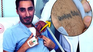 Göğsünün sağ tarafındaki ağrı nedeniyle hastaneye gitti, dünyada on binde bir görülen hastalıkla dünyaya geldiğini öğrendi! Hastalığının adını dövme yaptırdı