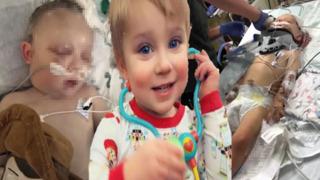 2 yaşındaki çocuk bebek bakıcısı tarafından dövüldükten sonra yaşam mücadelesi veriyor! Çocuğun halini görünce gözlerine inanamadı... Tek bildiğim içki içtiydi