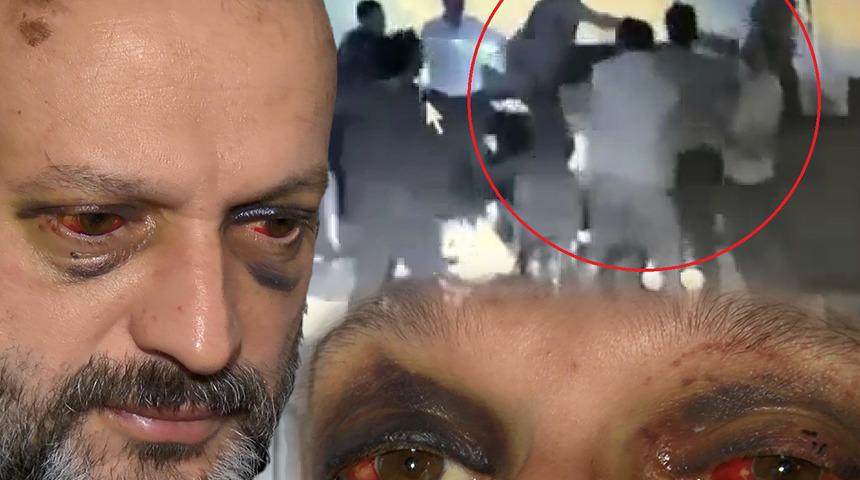 Bursa'da istek parça dehşeti! Hayatı tamamen değişti, müzisyenliği bırakıp şimdi bu işi yapıyor: 'Hayvanca saldırdılar'