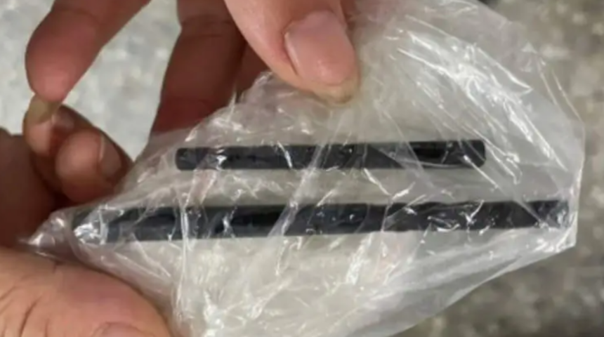 5 aydır baş ağrısı çeken adam beynine yemek çubuklarının saplandığını öğrendi! Gördüklerine kendisi bile anlam veremedi