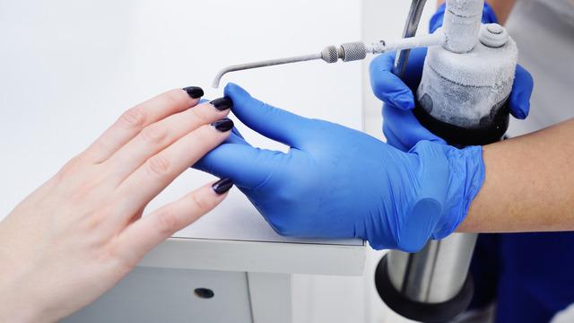 Siğil nedir, neden olur? Siğil nasıl geçer, ne iyi gelir?