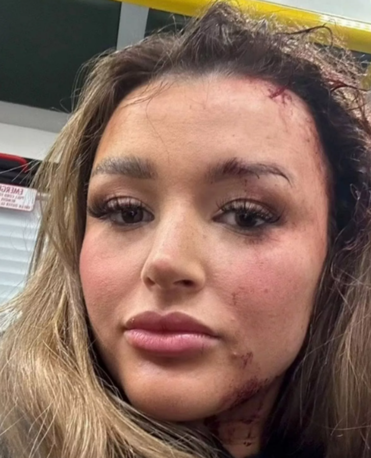 Selfie çektiği için sosyal medya fenomeninin kafasına yumruk attı! "Bunu hak etmiştin" diyerek kendisini savundu G1