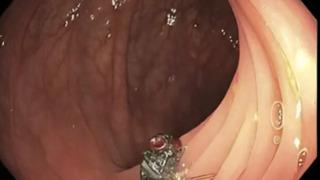 Kolonunda keşfedilen canlı sinek doktorları şok etti! Bu daha önce duyulmamış bir şey