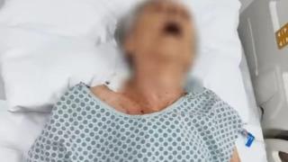 Öldüğünü zannettiler! Morgun içindeki ceset torbasında nefes aldığı fark edildi... Ölü ilan edilen kadın canlı çıktı